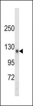 ANTI-SDCCAG33 (CENTER) antibody produced in rabbit purified immunoglobulin, buffered aqueous solution