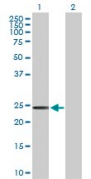 Anti-SSPN antibody produced in rabbit purified immunoglobulin, buffered aqueous solution