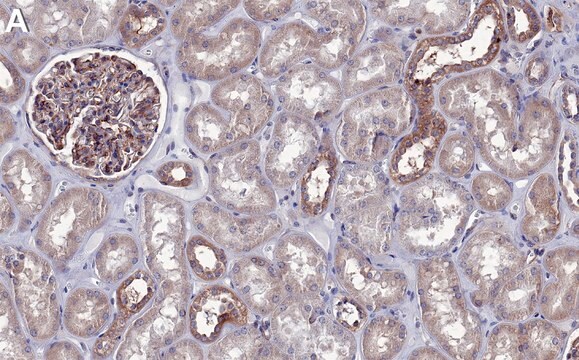 Anti-ROCK-1 Antibody, clone 3K23 ZooMAb&#174; Rabbit Monoclonal recombinant, expressed in HEK 293 cells