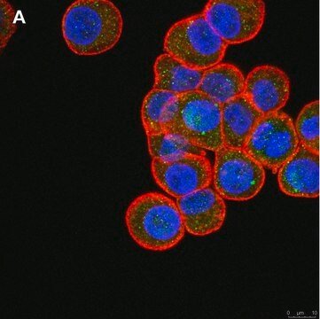 Anti-ULBP-4/RAET1E Antibody, clone 6C10 ZooMAb&#174; Rabbit Monoclonal recombinant, expressed in HEK 293 cells