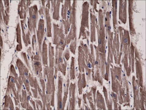 Anti-Acetyl-CoA Carboxylase antibody, Rabbit monoclonal recombinant, expressed in HEK 293 cells, clone RM232, purified immunoglobulin