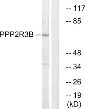 Anti-PPP2R3B antibody produced in rabbit affinity isolated antibody