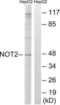 Anti-CNOT2 antibody produced in rabbit affinity isolated antibody