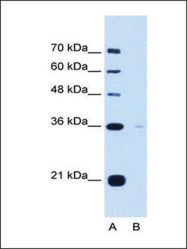 Anti-TOR1B antibody produced in rabbit IgG fraction of antiserum