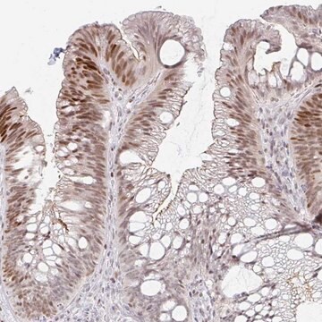 Anti-C11orf53 antibody produced in rabbit Prestige Antibodies&#174; Powered by Atlas Antibodies, affinity isolated antibody, buffered aqueous glycerol solution