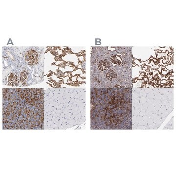 抗ICAM1 ウサギ宿主抗体 Prestige Antibodies&#174; Powered by Atlas Antibodies, affinity isolated antibody, buffered aqueous glycerol solution