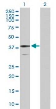 Anti-BDH1 antibody produced in rabbit purified immunoglobulin, buffered aqueous solution