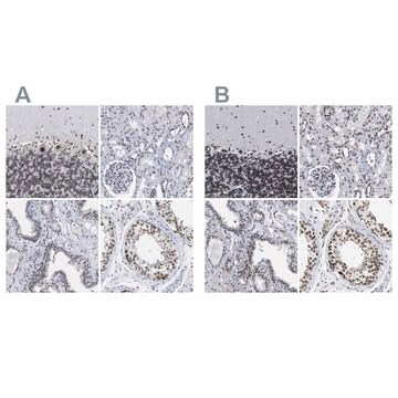 Anti-TPR antibody produced in rabbit Prestige Antibodies&#174; Powered by Atlas Antibodies, affinity isolated antibody, buffered aqueous glycerol solution, Ab2