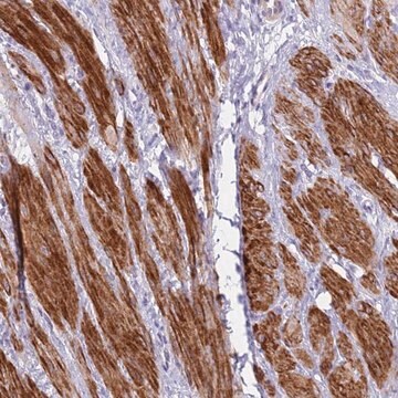 Anti-KBTBD3 antibody produced in rabbit Prestige Antibodies&#174; Powered by Atlas Antibodies, affinity isolated antibody, buffered aqueous glycerol solution