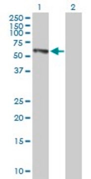 抗EPHX2抗体 マウス宿主抗体 IgG fraction of antiserum, buffered aqueous solution