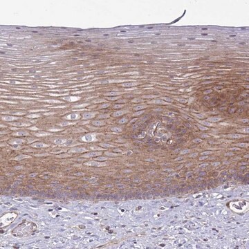 Anti-SH2D1B antibody produced in rabbit Prestige Antibodies&#174; Powered by Atlas Antibodies, affinity isolated antibody, buffered aqueous glycerol solution