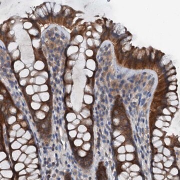 Anti-PDSS1 antibody produced in rabbit Prestige Antibodies&#174; Powered by Atlas Antibodies, affinity isolated antibody, buffered aqueous glycerol solution