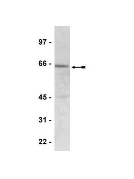 Anti-Phospho-AMPK &#945; (Thr172)-Antikörper Upstate&#174;, from rabbit