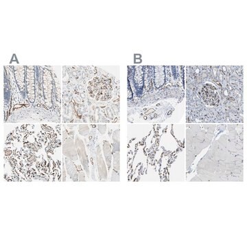 抗-CD93 兔抗 Prestige Antibodies&#174; Powered by Atlas Antibodies, affinity isolated antibody, buffered aqueous glycerol solution