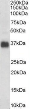 Anti-Clusterin/APOJ (AB1) antibody produced in goat affinity isolated antibody, buffered aqueous solution