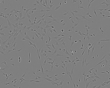 Linia komórkowa 1321N1 NOTE: Both the cell line and DNA from the cell line may be available for this product. Please choose -1VL or VIAL for cells, or -DNA-5UG for DNA. 86030402, human brain (astrocytoma), Glial