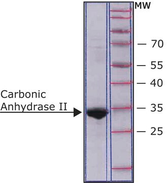 炭酸脱水酵素II ヒト recombinant, expressed in E. coli, buffered aqueous solution