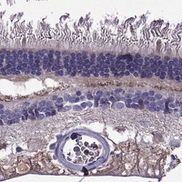 Anti-PI16 antibody produced in rabbit Prestige Antibodies&#174; Powered by Atlas Antibodies, affinity isolated antibody