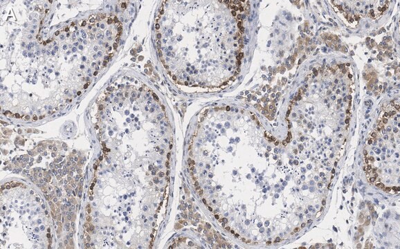 Anti-FMR1 (C-terminal) Antibody, clone 2B16 ZooMAb&#174; Rabbit Monoclonal recombinant, expressed in HEK 293 cells