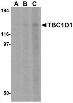 Anti-TBC1D1 antibody produced in rabbit affinity isolated antibody, buffered aqueous solution