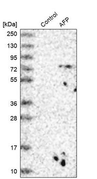 Anti-AFP antibody produced in rabbit Prestige Antibodies&#174; Powered by Atlas Antibodies, affinity isolated antibody, buffered aqueous glycerol solution