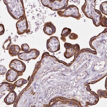 Anti-DCTN4 antibody produced in rabbit Prestige Antibodies&#174; Powered by Atlas Antibodies, affinity isolated antibody, buffered aqueous glycerol solution