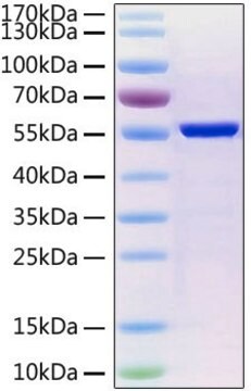 Recombinant 2019-nCoV Nucleocapsid Protein with His tag