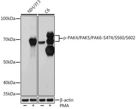 Anti-Phospho-PAK4/PAK5/PAK6-S474/S560/S602 antibody produced in rabbit