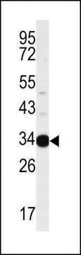 ANTI-AIG1 (N-TERM) antibody produced in rabbit IgG fraction of antiserum, buffered aqueous solution