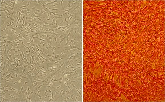 Bovine Pulmonary Artery Smooth Muscle Cells: BPASMC (Cryovial)