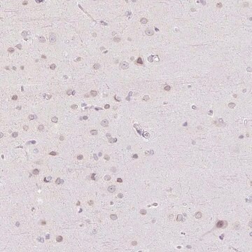 抗TBX15 ウサギ宿主抗体 Prestige Antibodies&#174; Powered by Atlas Antibodies, affinity isolated antibody, buffered aqueous glycerol solution