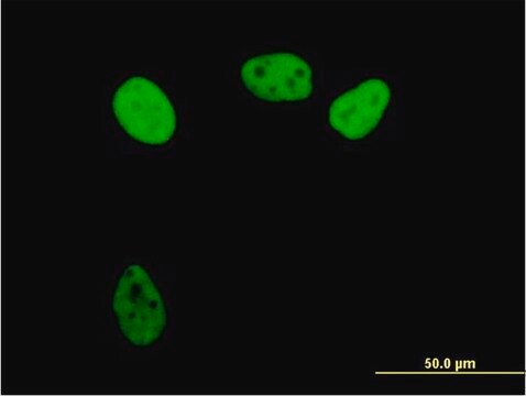 Anti-RPA1 antibody produced in mouse purified immunoglobulin, buffered aqueous solution