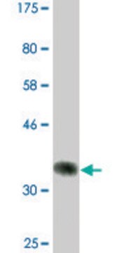 Monoclonal Anti-UBR2, (N-terminal) antibody produced in mouse clone 4G4, ascites fluid