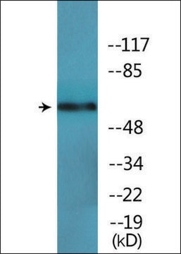 Anti-phospho-RelB (pSer552) antibody produced in rabbit affinity isolated antibody