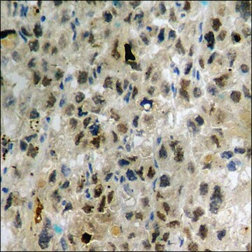 Anti-phospho-ARHGDIA (pSer174) antibody produced in rabbit affinity isolated antibody