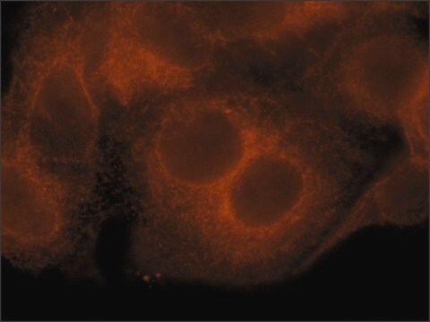 Anti-SEL1L (N-terminal) antibody produced in rabbit ~1.0&#160;mg/mL, affinity isolated antibody, buffered aqueous solution