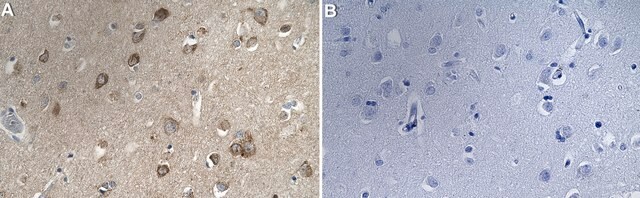 Anti-Neurexin-1-&#946; Antibody, clone 1F14 ZooMAb&#174; Rabbit Monoclonal recombinant, expressed in HEK 293 cells