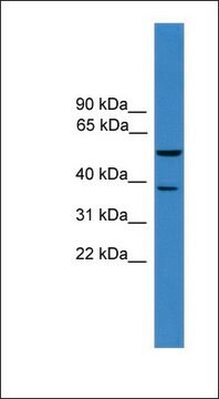 抗BACE1抗体 ウサギ宿主抗体 affinity isolated antibody