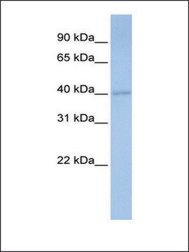 Anti-PDSS1 (AB1) antibody produced in rabbit affinity isolated antibody