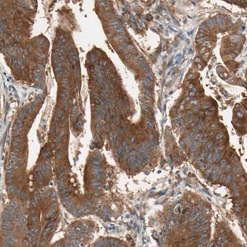 Anti-ROCK2 antibody produced in rabbit Prestige Antibodies&#174; Powered by Atlas Antibodies, affinity isolated antibody, buffered aqueous glycerol solution