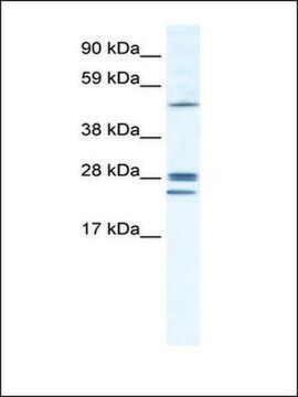 Anti-GJB2 antibody produced in rabbit IgG fraction of antiserum