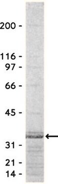 Odczynnik do testu Rho (Rhotekin RBD, agaroza), 650 µg Specifically binds to &amp; precipitates GTP-Rho, but not GDP-Rho from cell lysates. For use in Affinity Binding Assays.