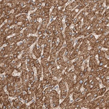 Anti-ABCC11 antibody produced in rabbit Prestige Antibodies&#174; Powered by Atlas Antibodies, affinity isolated antibody, buffered aqueous glycerol solution