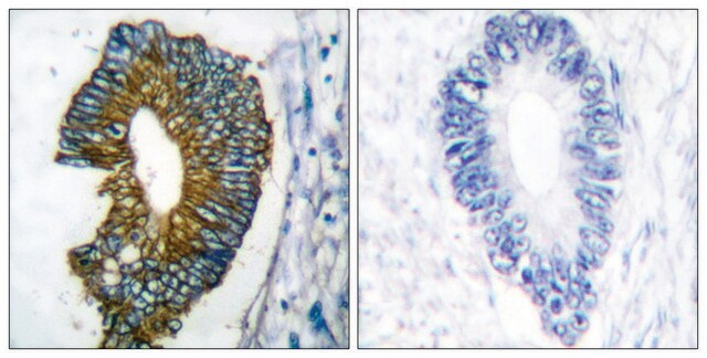 Anti-Keratin 18 antibody produced in rabbit affinity isolated antibody