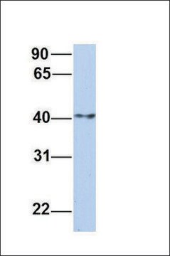 Anti-ERLIN1 antibody produced in rabbit affinity isolated antibody