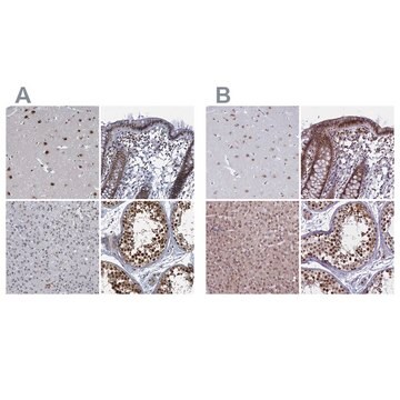 Anti-PPHLN1 antibody produced in rabbit Prestige Antibodies&#174; Powered by Atlas Antibodies, affinity isolated antibody, buffered aqueous glycerol solution