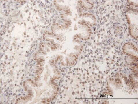 Anti-FKBP5 antibody produced in mouse purified immunoglobulin, buffered aqueous solution