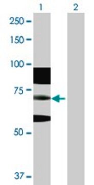 Anti-RNF168 antibody produced in rabbit purified immunoglobulin, buffered aqueous solution