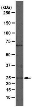 Przeciwciało anty-VHL, klon 11E12 clone 11E12, from mouse