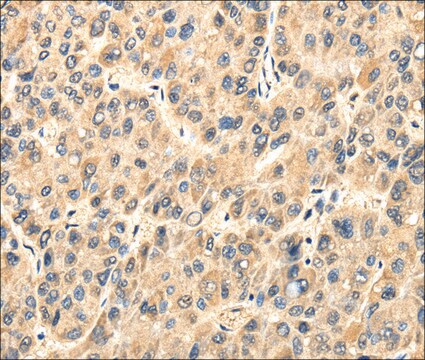 Anti-TWIST2 affinity isolated antibody